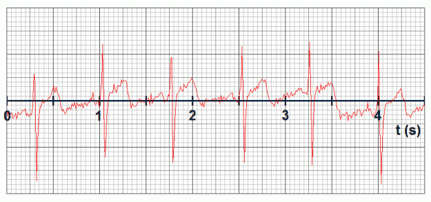 Click to Enlarge

Name: ecg1.gif
Size: 45 KB