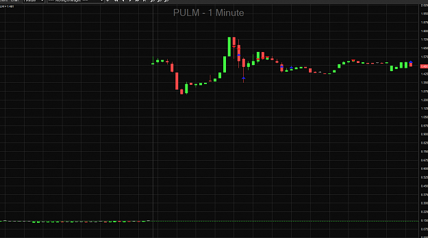 Click to Enlarge

Name: Screenshot_pulm.png
Size: 50 KB